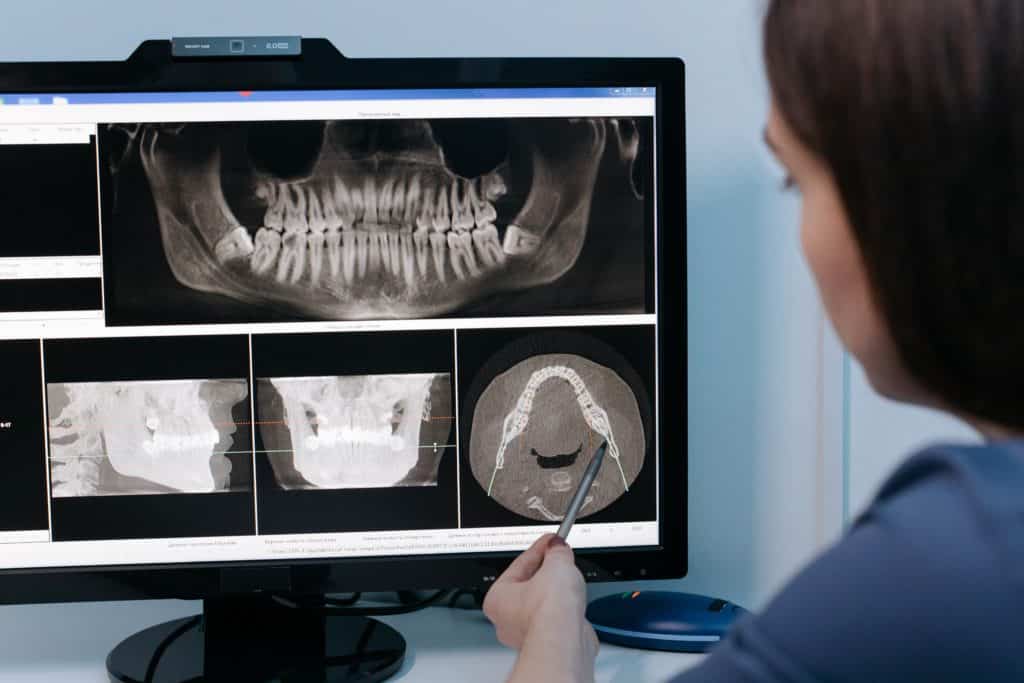 Dental Insurance Claims Processing 101 Smart Data Solutions